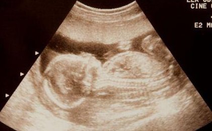 泰国和国内试管婴儿区别